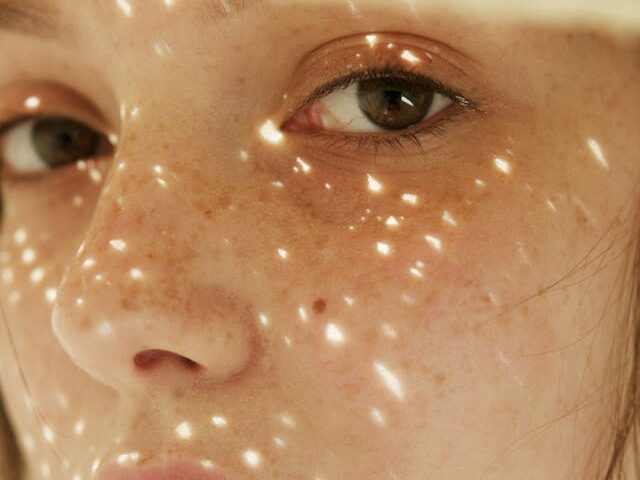 Rhinoplasty Procedure