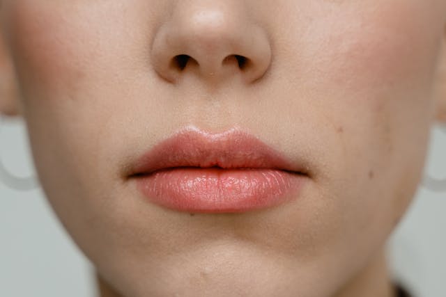 Managing Expectations Before a Nose Job