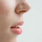 Weeks 3–4 of Rhinoplasty Recovery