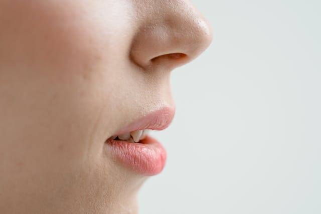 Weeks 3–4 of Rhinoplasty Recovery